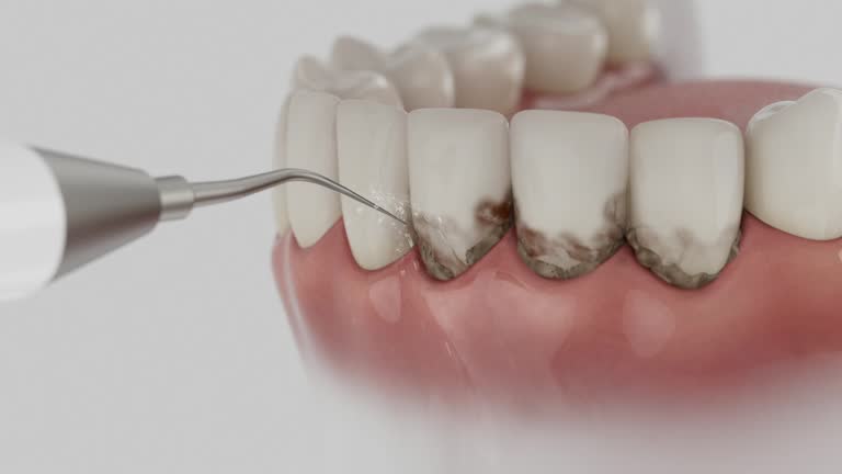 Trusted Invisalign Clear Aligners service in McGaheysville, VA - Dentist Open Now
